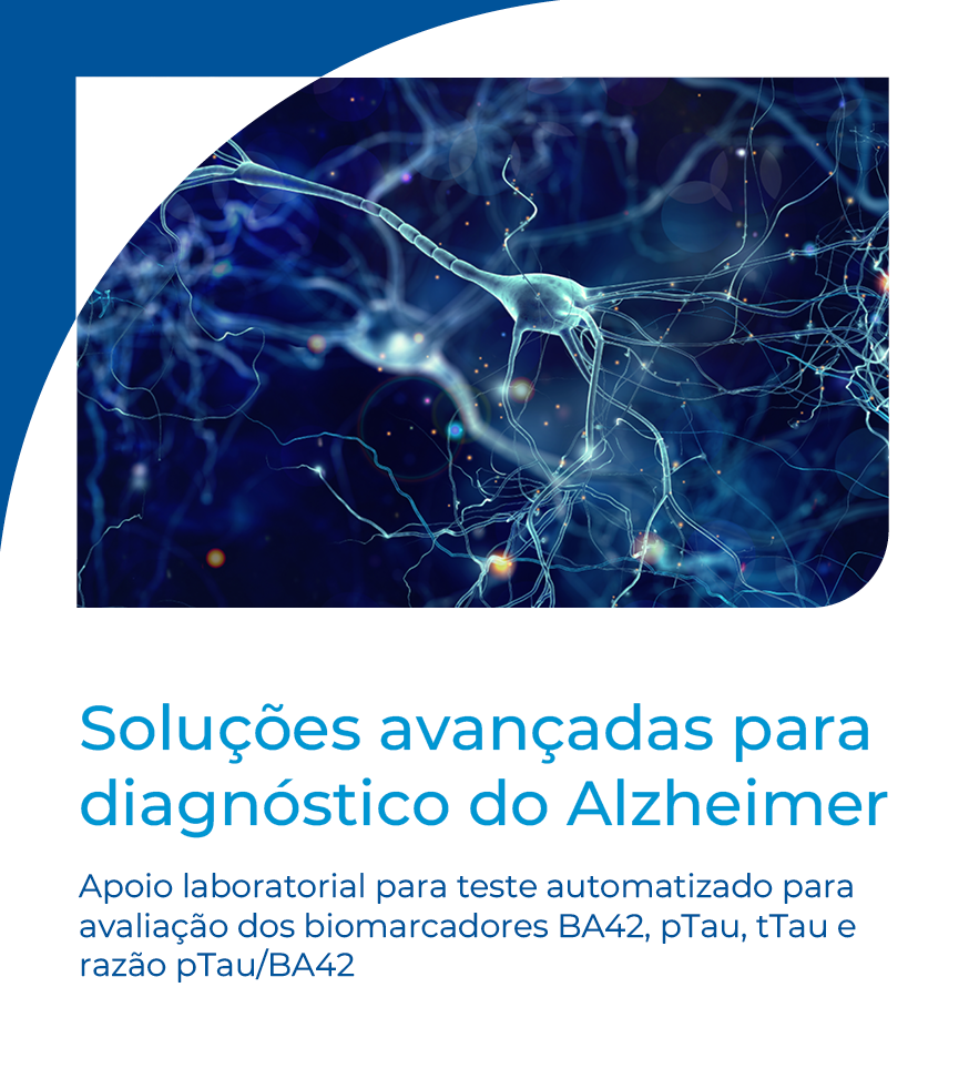 alzheimer